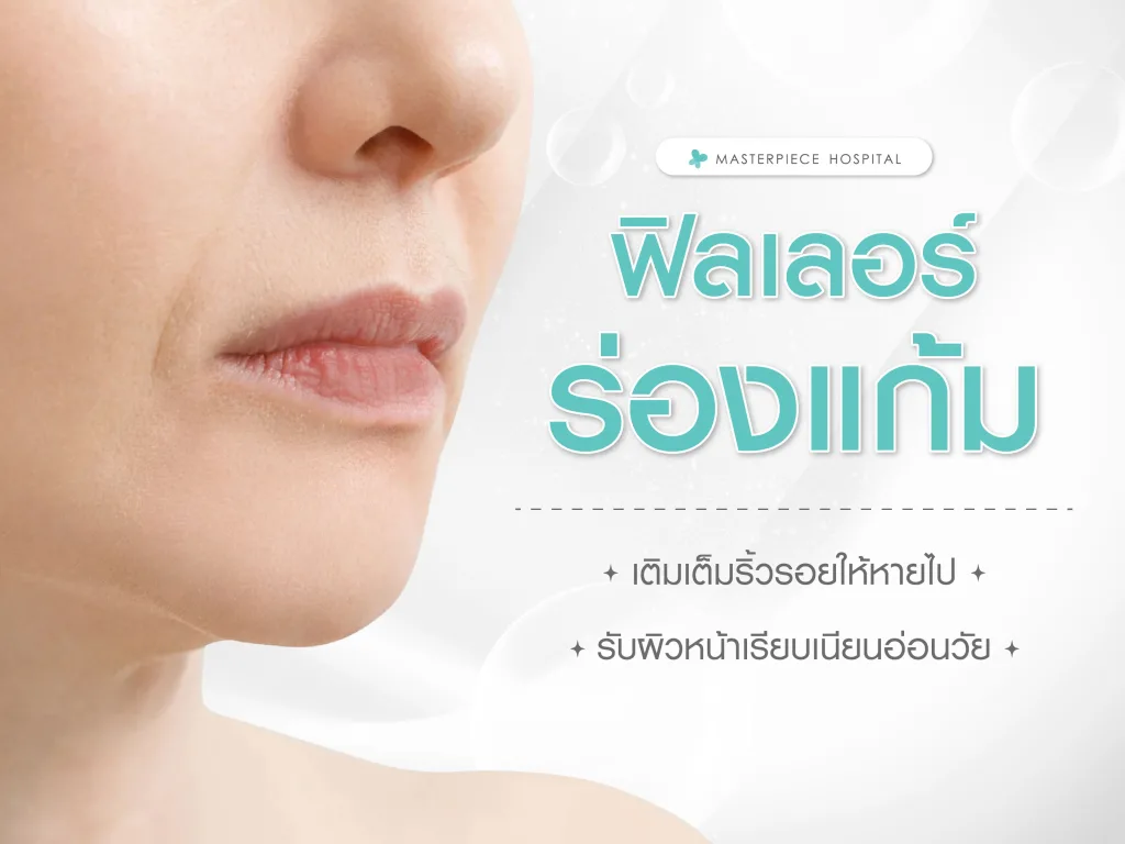 ฟิลเลอร์ร่องแก้ม เติมเต็มริ้วรอยให้หายไป รับผิวหน้าเรียบเนียนอ่อนวัย