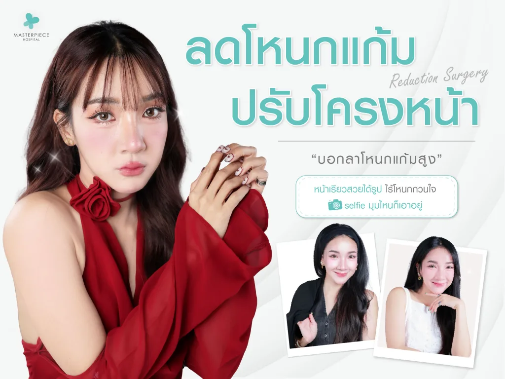 ผู้หญิงใช้มือจับหน้า พร้อมหน้าตายิ้มแย้ม หลังทำศัลยกรรมตัดโหนกแก้ม