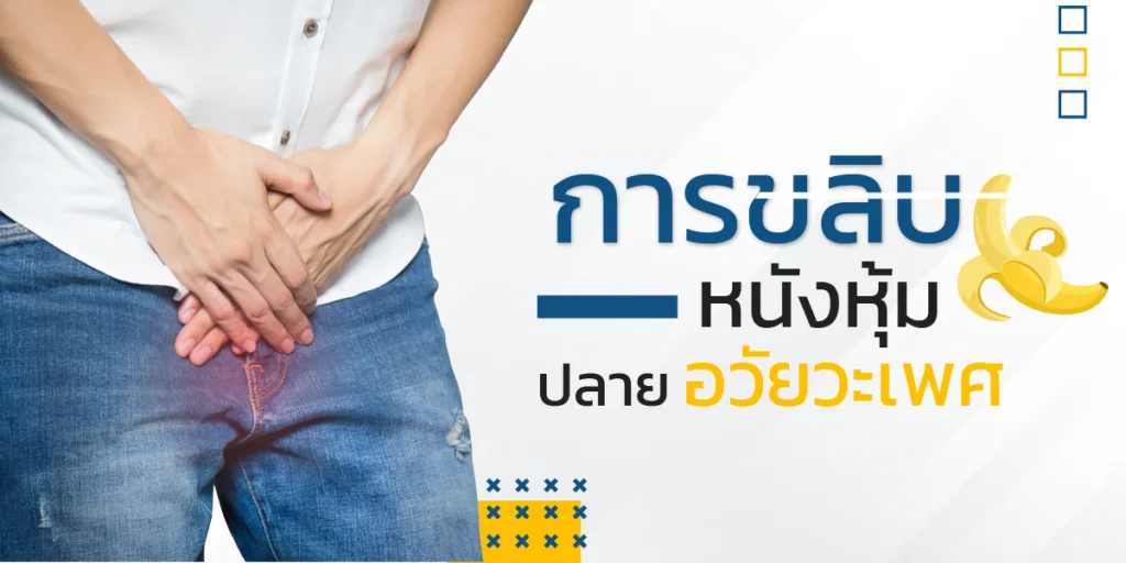 การขลิบหนังหุ้มปลายอวัยวะเพศ ด้วยเทคนิคไร้เลือด แผลหายไว เจ็บน้อย