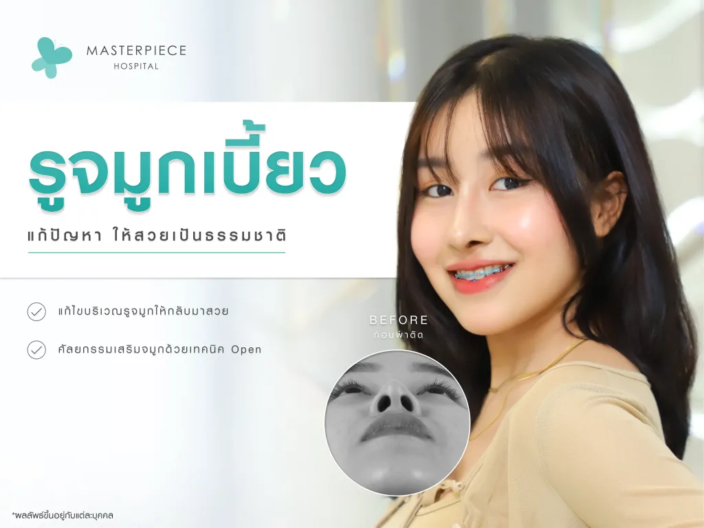 ผู้หญิงหันข้าง โชว์จมูก กับข้อความแก้ปัญหารูจมูกเบี้ยวอย่างไรให้สวยธรรมชาติ