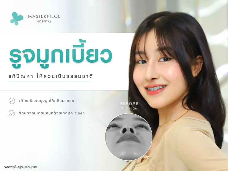 ผู้หญิงหันข้าง โชว์จมูก กับข้อความแก้ปัญหารูจมูกเบี้ยวอย่างไรให้สวยธรรมชาติ
