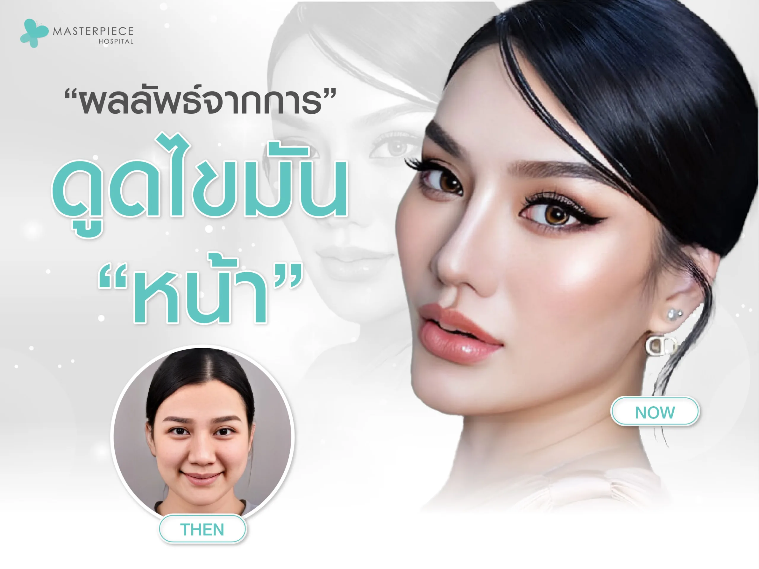 ผลลัพธ์จากการดูดไขมันหน้า บริเวณต่าง ๆ