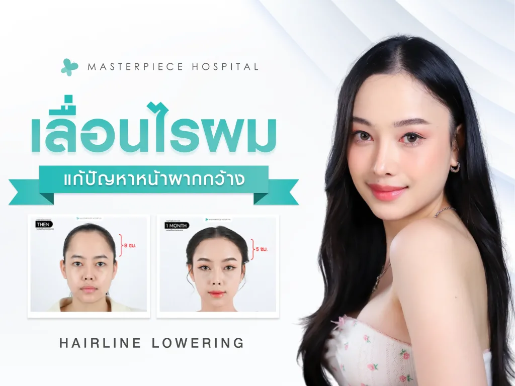 ผู้หญิงหน้าตรงยิ้มและกอดอก มีเส้นกราฟิกช่วงหน้าผากแสดงให้เห็นถึงการเลื่อนไรผม