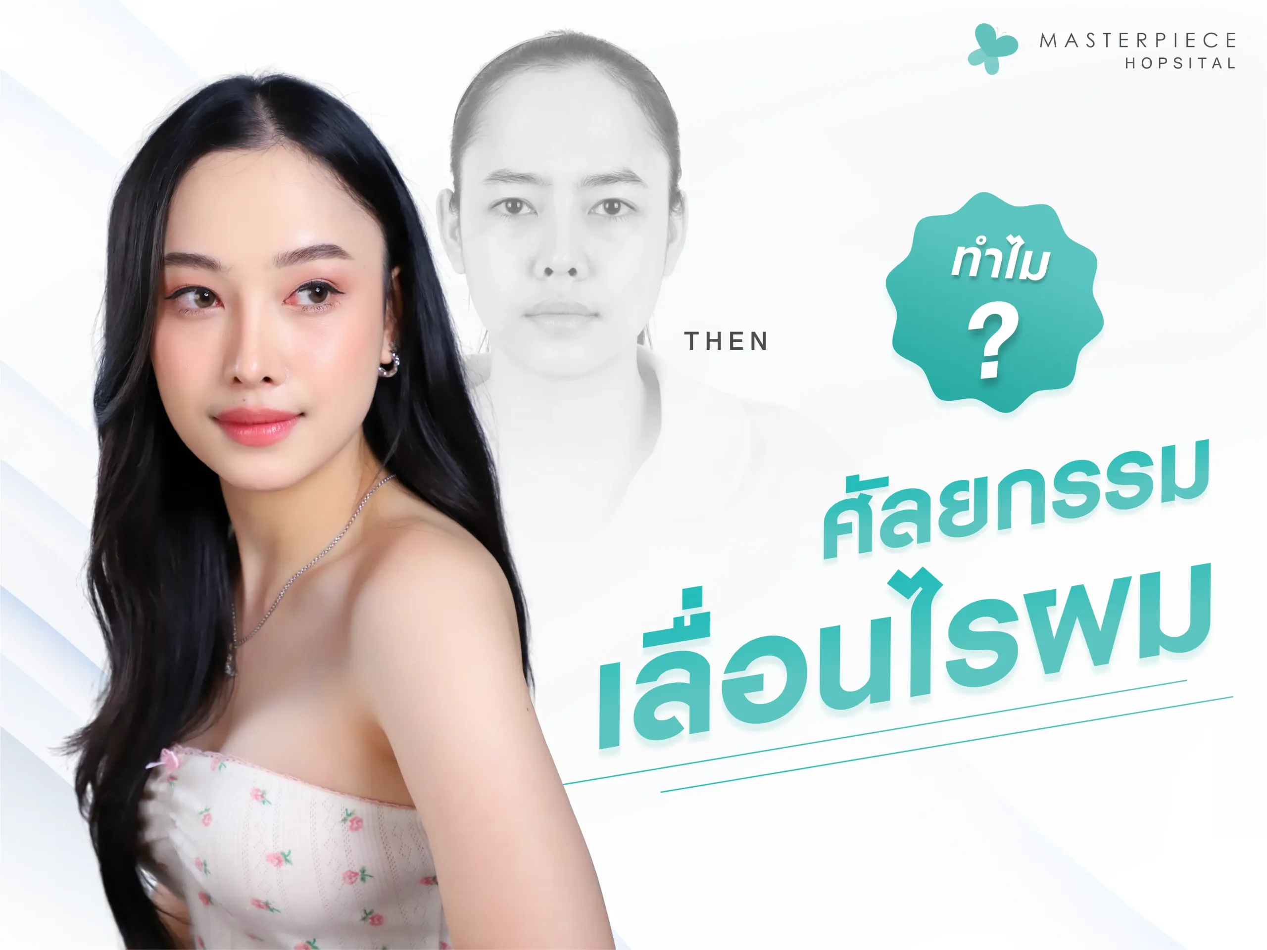 ทำไมต้องศัลยกรรมเลื่อนไรผม ลดหน้าผาก ทำไมต้องศัลยกรรมเลื่อนไรผม ลดหน้าผาก