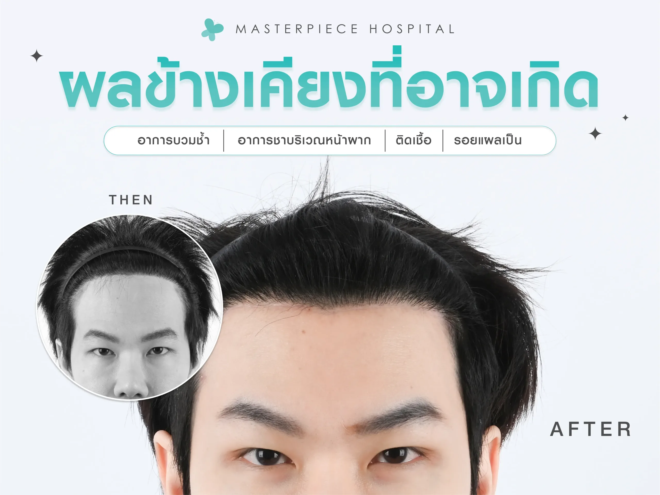 ผลข้างเคียงที่อาจเกิดขึ้น ผลข้างเคียงที่อาจเกิดขึ้น