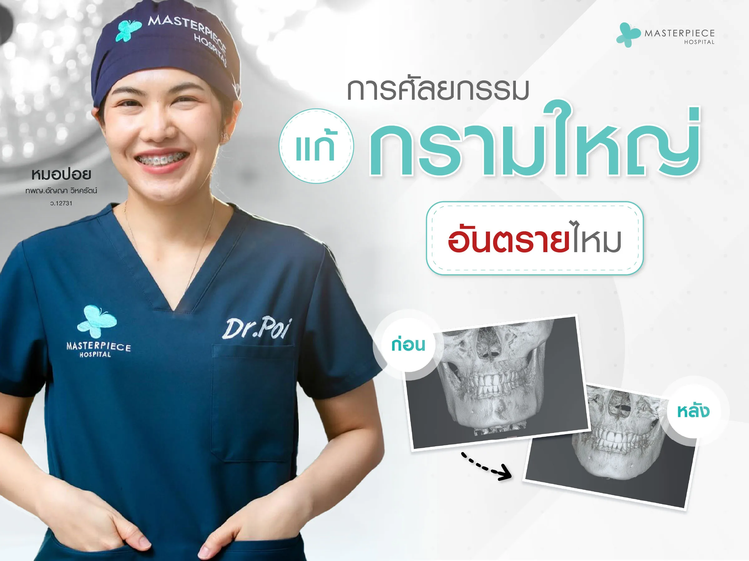 การศัลยกรรมแก้กรามใหญ่
