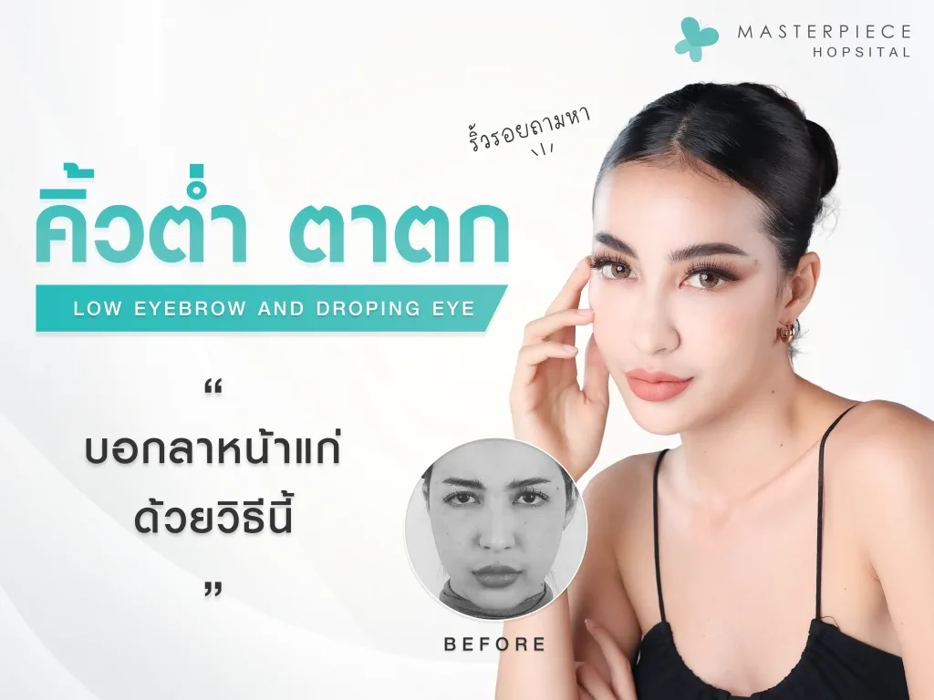 ผู้หญิงหน้าตรงทำหน้าตากังวล กับข้อความ คิ้วต่ำ หนังตาตก ริ้วรอบถามหา บอกลาหน้าแก่