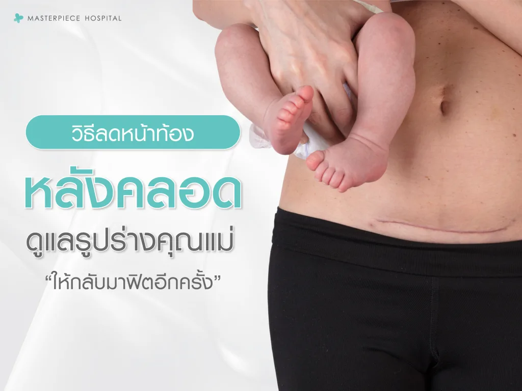 วิธีลดหน้าท้องหลังคลอด ดูแลรูปร่างคุณแม่ให้กลับมาฟิตอีกครั้ง