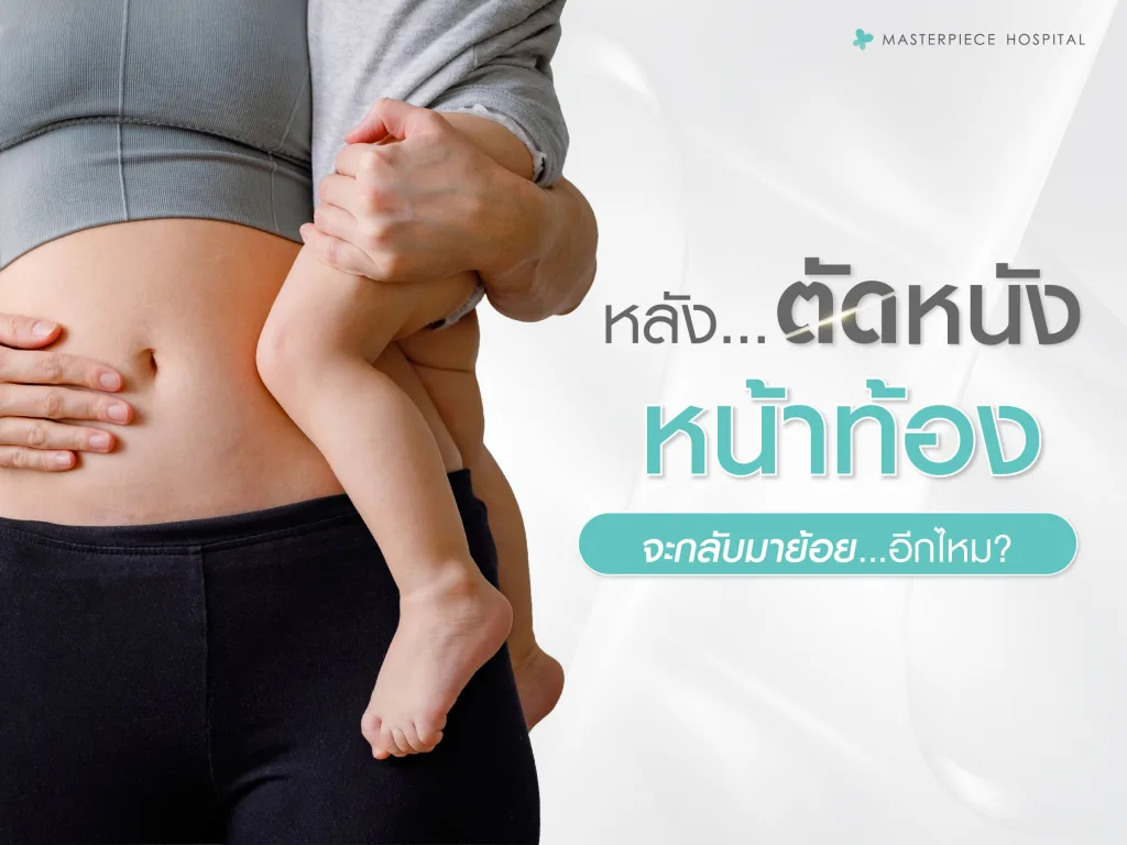 หลังตัดหนังหน้าท้องจะกลับมาย้อยอีกไหม