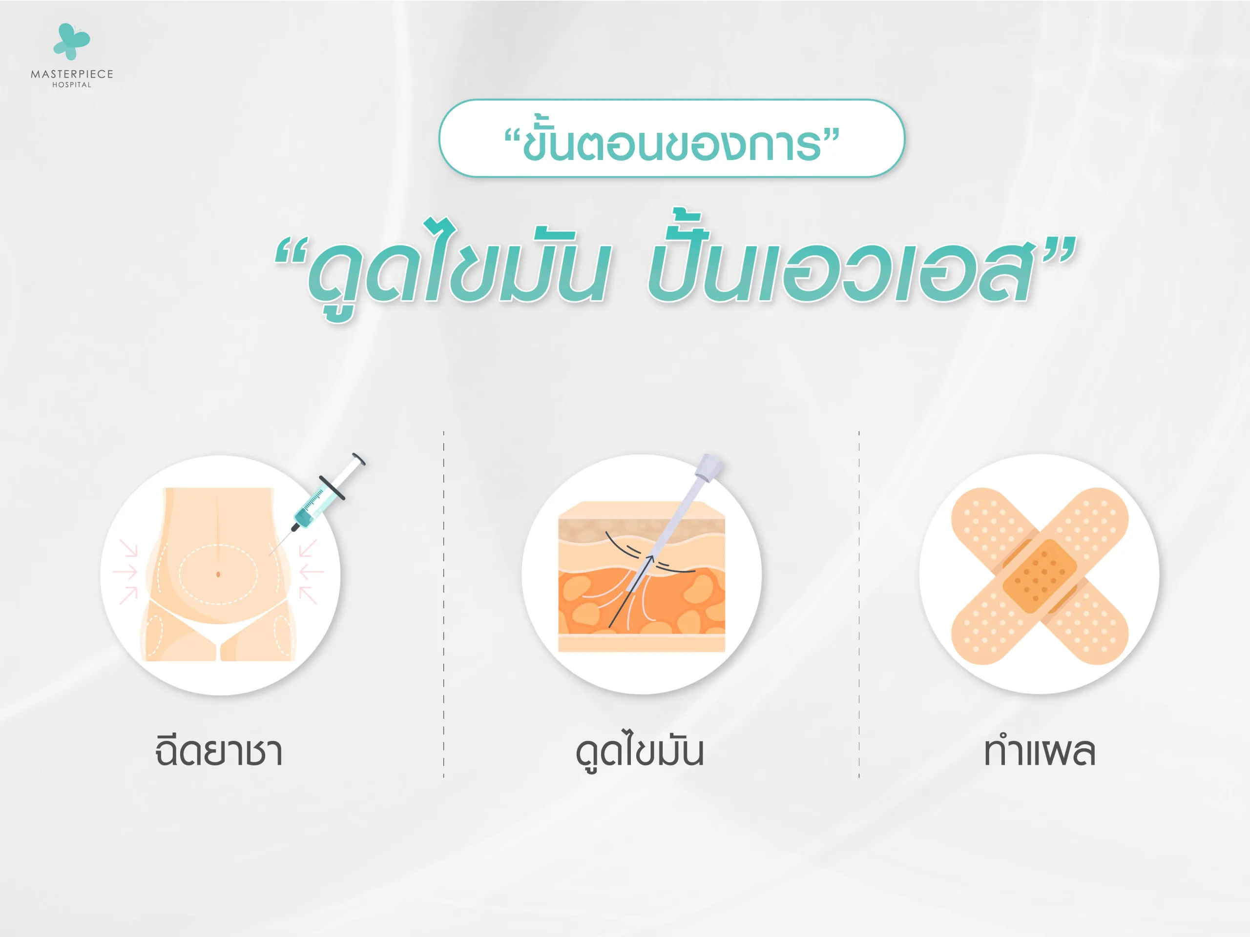 ขั้นตอนการ ดูดไขมันปั้นเอวเอส มีอะไรบ้าง