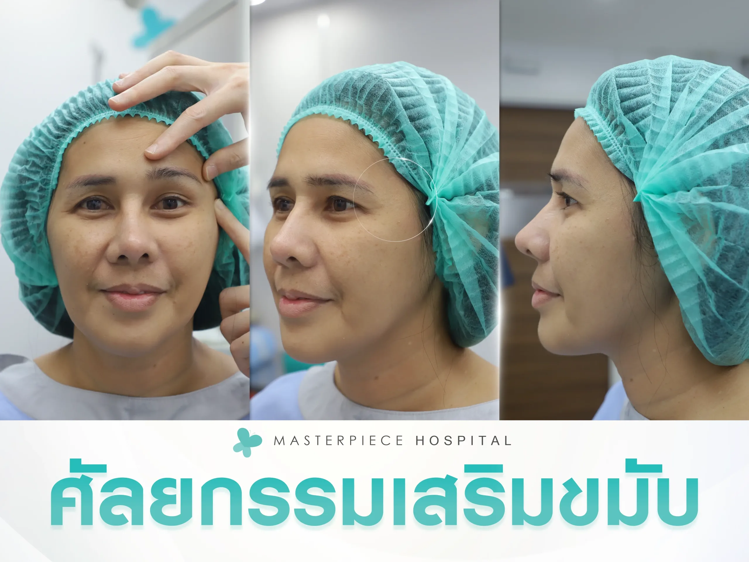 ขั้นตอนการผ่าตัดศัลยกรรมเสริมขมับ