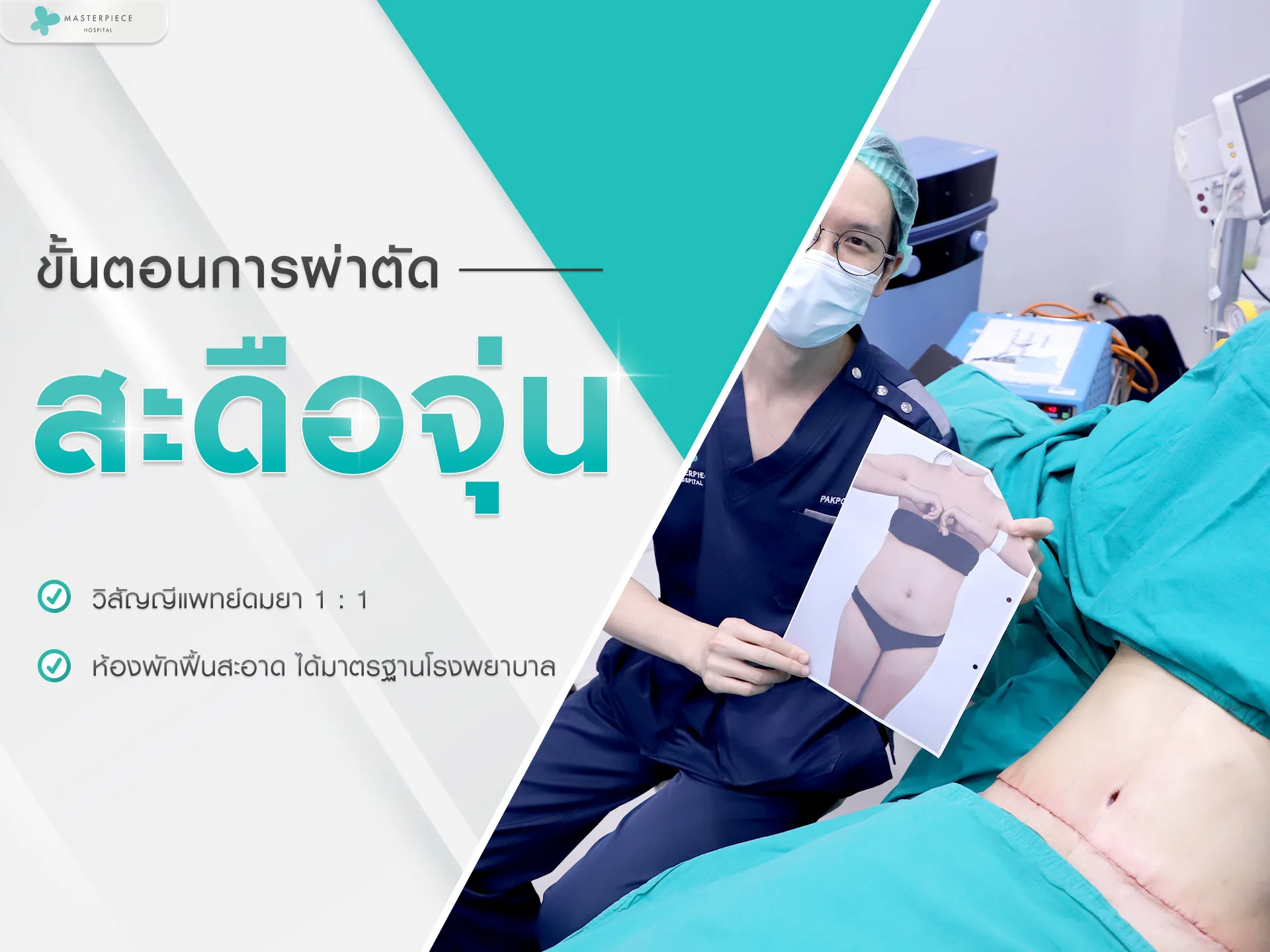 ขั้นตอนการผ่าตัดแก้ไขสะดือจุ่น