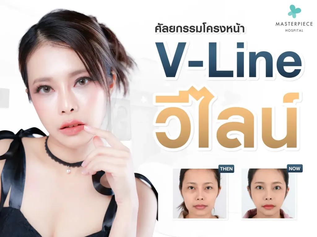 ทำวีไลน์ปรับโครงหน้าคือการปรับโครงสร้างหน้า ให้เข้ารูป V shape สวย หล่อ ใสสไตล์เกาหลี
