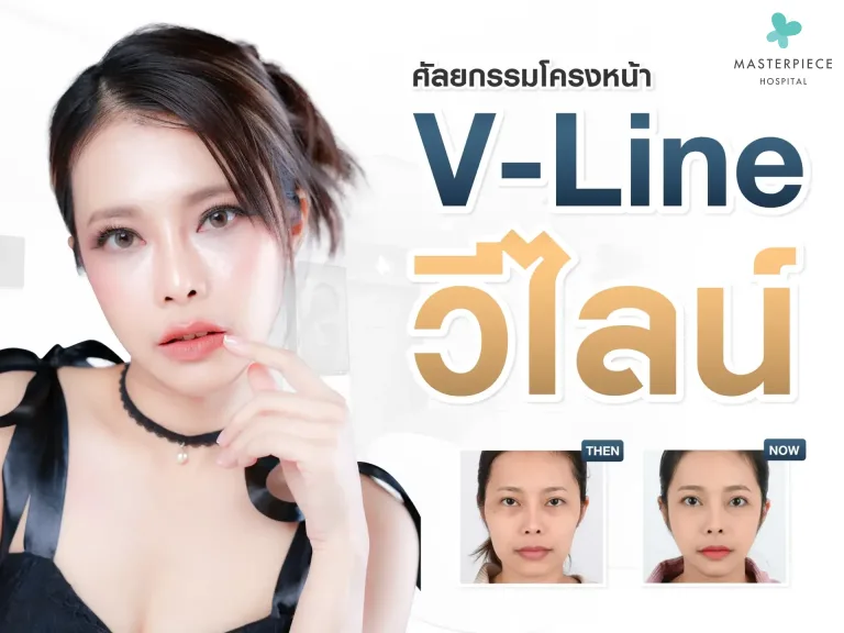 ทำวีไลน์ปรับโครงหน้าคือการปรับโครงสร้างหน้า ให้เข้ารูป V shape สวย หล่อ ใสสไตล์เกาหลี