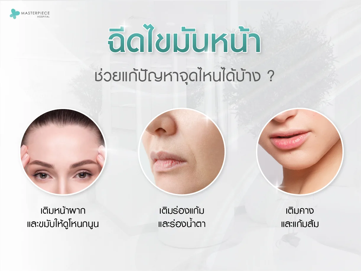 ฉีดไขมันหน้าช่วยอะไร