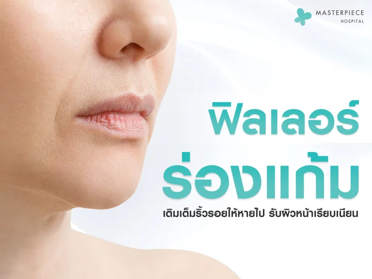 ฟิลเลอร์ร่องแก้ม เติมเต็มริ้วรอยให้หายไป รับผิวหน้าเรียบเนียนอ่อนวัย