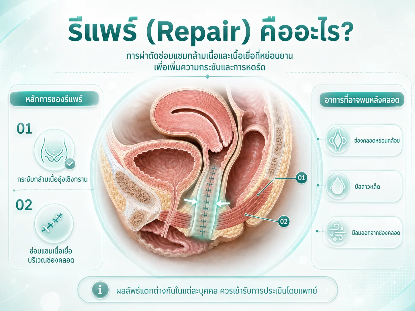 รีแพร์คืออะไร