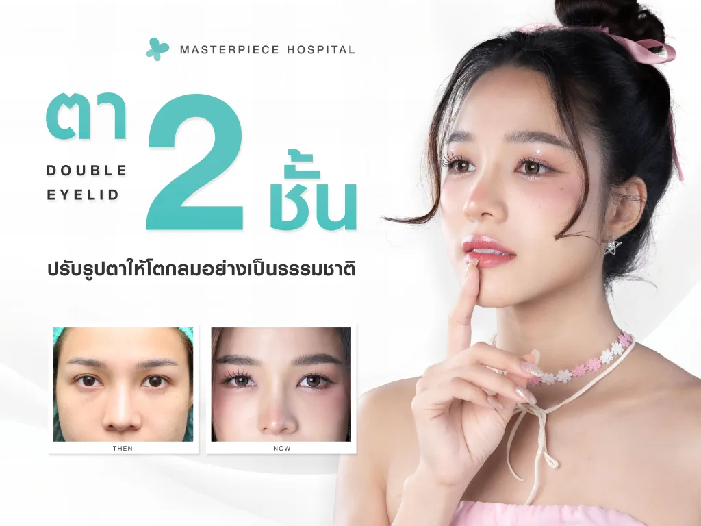 ศัลยกรรมตาสองชั้น (Double Eyelid) ปรับรูปตาให้กลมโตอย่างเป็นธรรมชาติ