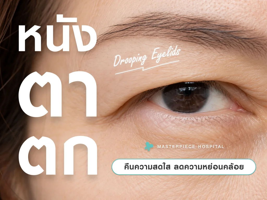 ศัลยกรรมแก้หนังตาตก (Drooping Eyelids)