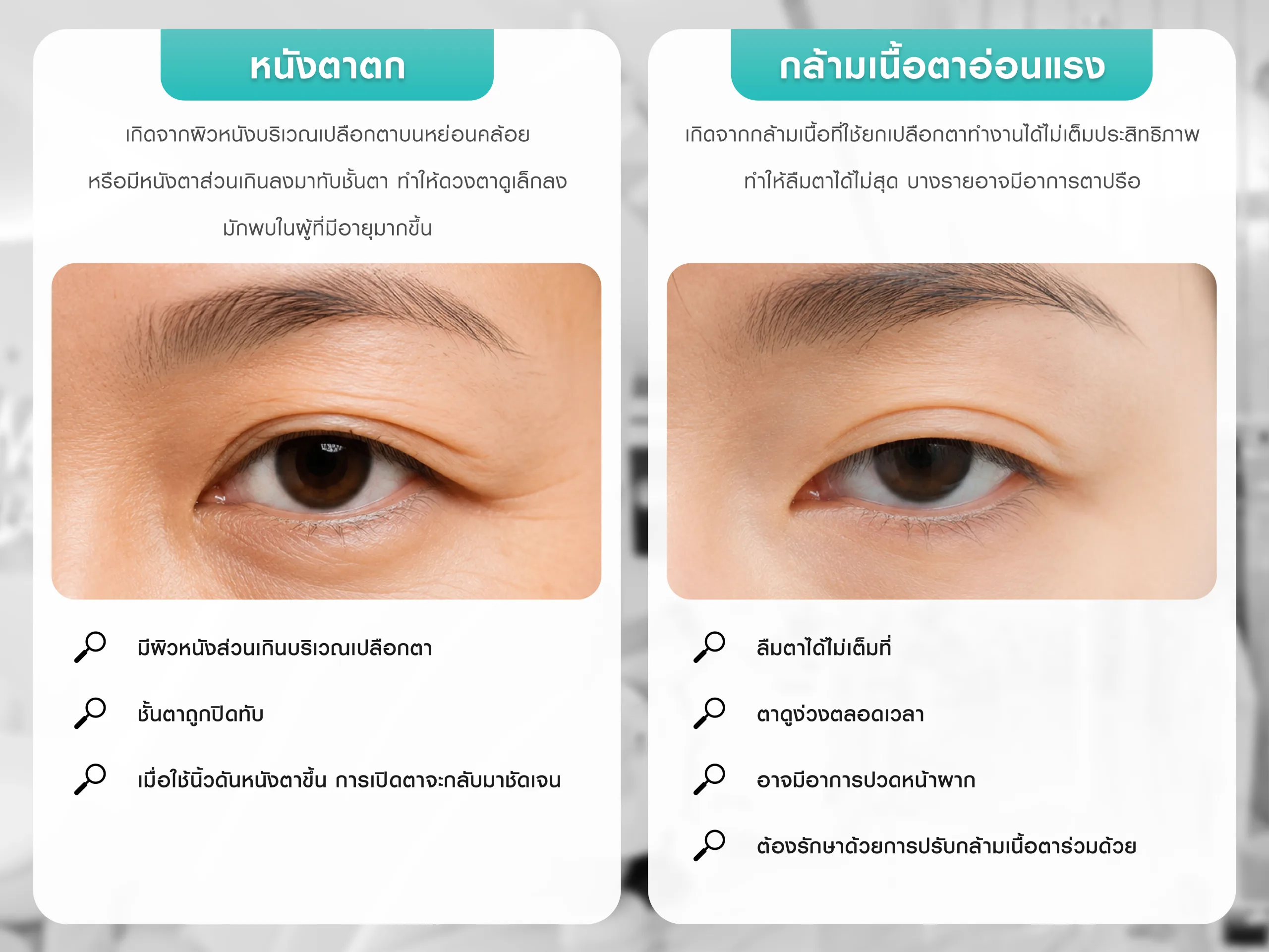 หนังตาตก แตกต่างจาก กล้ามเนื้อตาอ่อนแรง อย่างไร