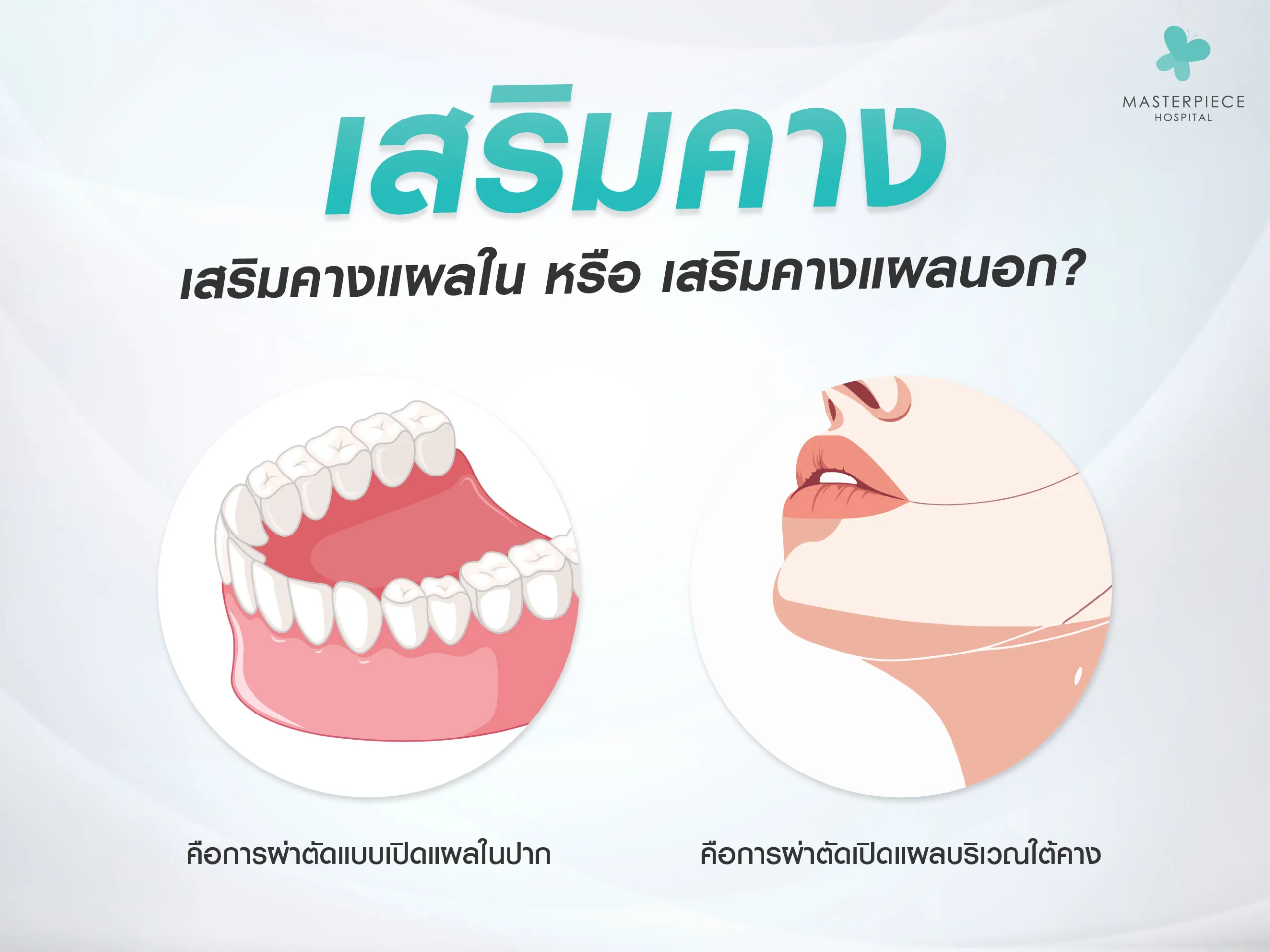 เสริมคางแผลใน หรือ เสริมคางแผลนอก ?