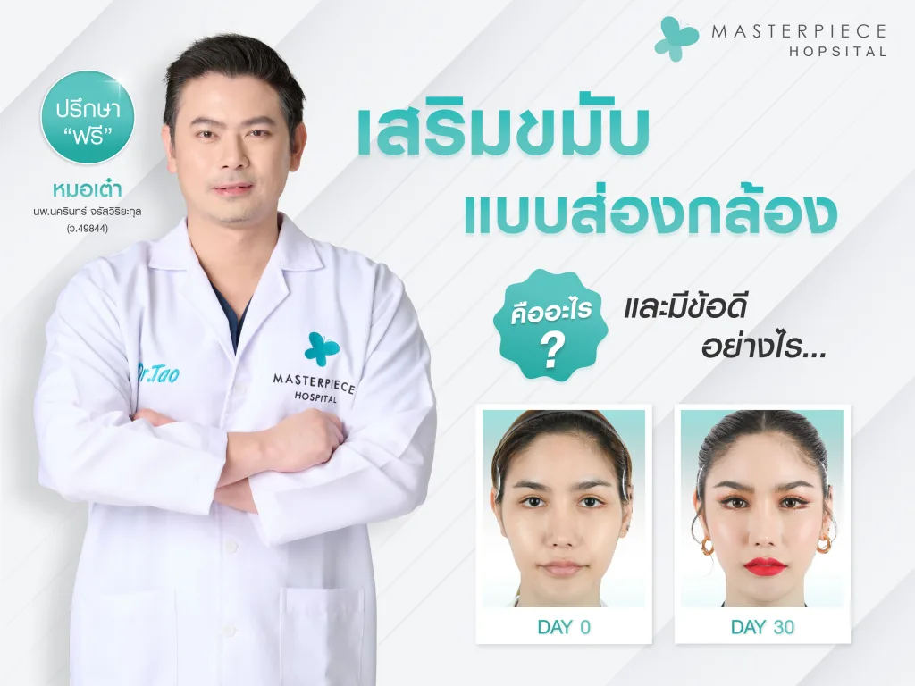 เสริมขมับแบบส่องกล้องคืออะไร และมีข้อดีอย่างไร