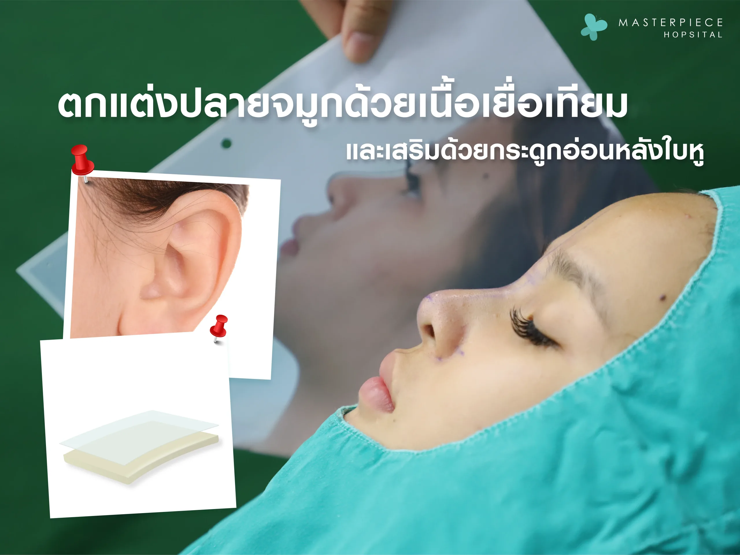 การตกแต่งปลายจมูกด้วยเนื้อเยื่อเทียม และเทคนิคการเสริมด้วยกระดูกอ่อนหลังใบหู