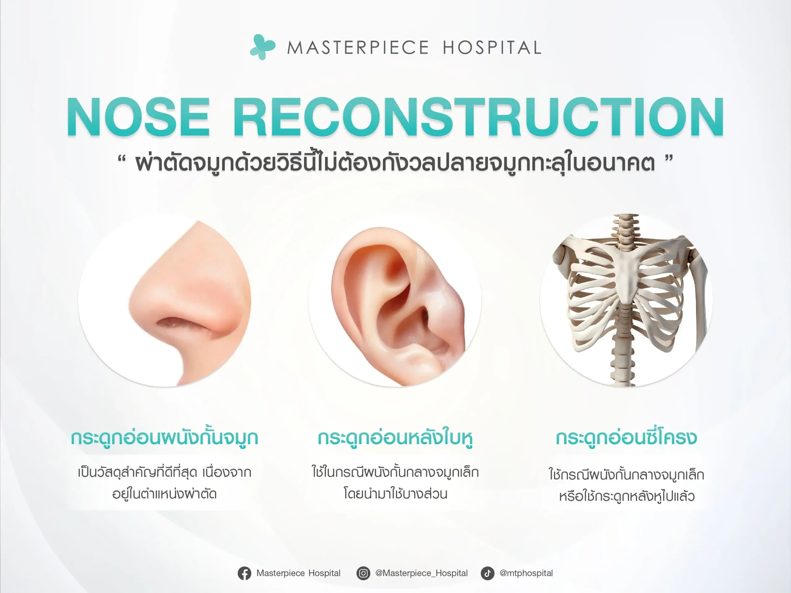 NOSE RECONSTRUCTION จมูกไร้ซิลิโคนโดยจะมีการใช้กระดูกอ่อนในร่างกายมาเสริมแทนซิลิโคน