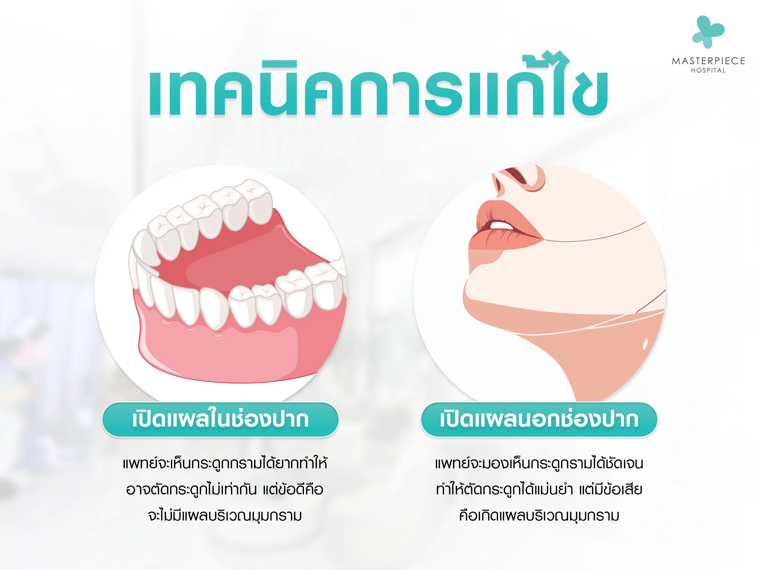 เทคนิคในการแก้ไขโครงหน้าเบี้ยว