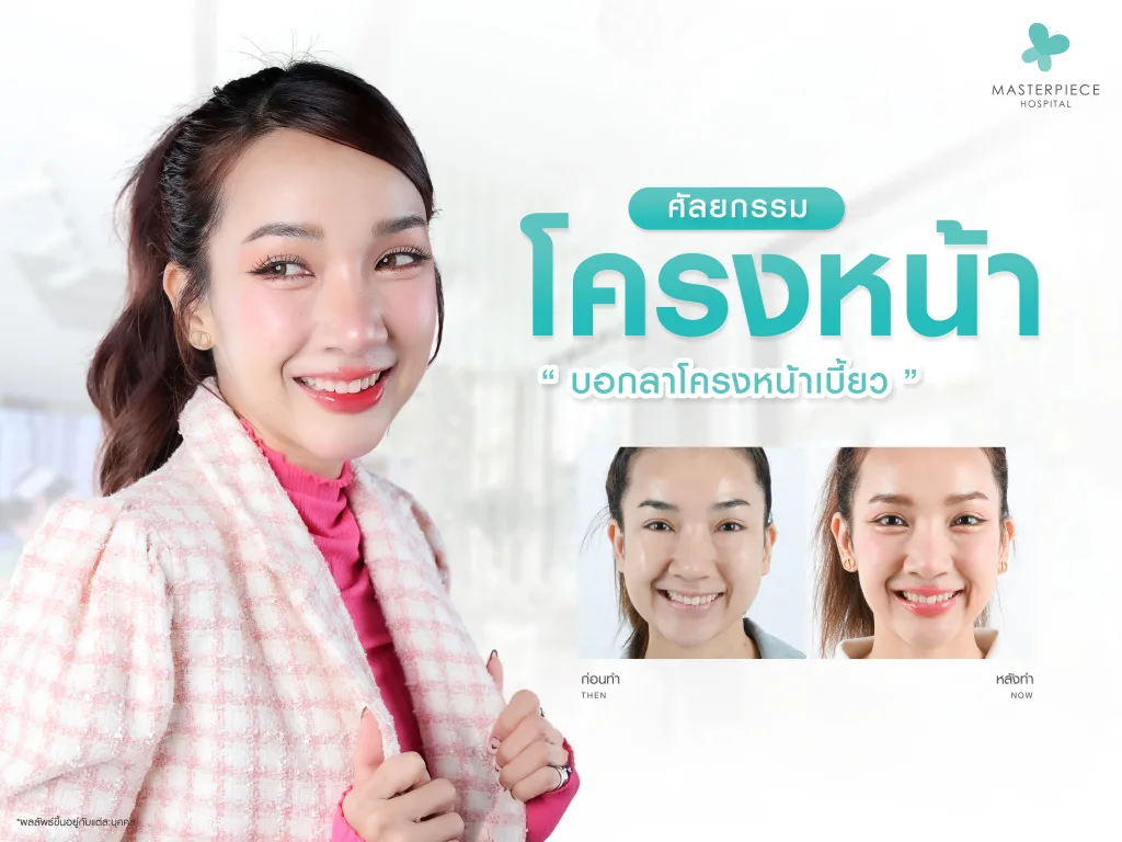 ศัลยกรรมโครงหน้าเบี้ยว