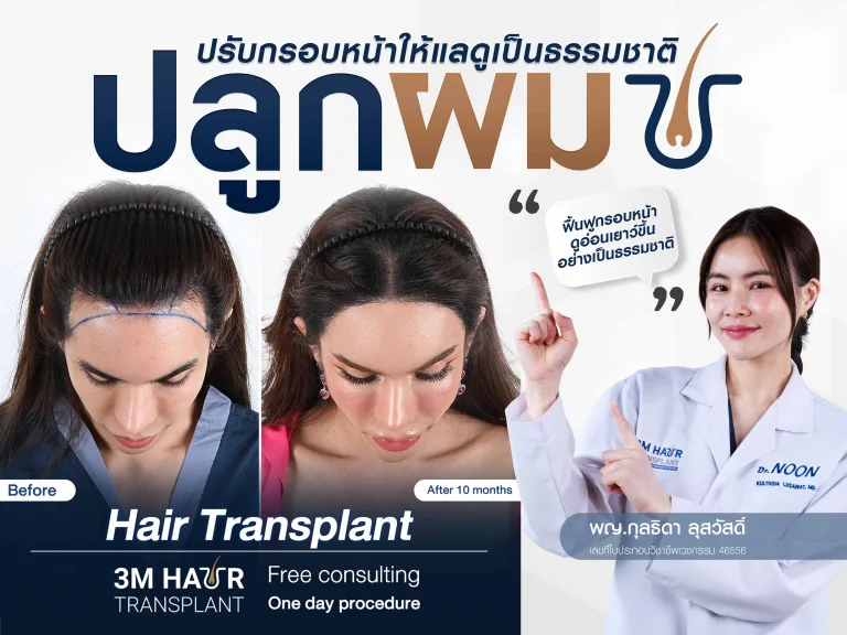 ปลูกผมปรับกรอบหน้า ฟื้นฟูกรอบหน้าผมให้กลับดูเป็นธรรมชาติ