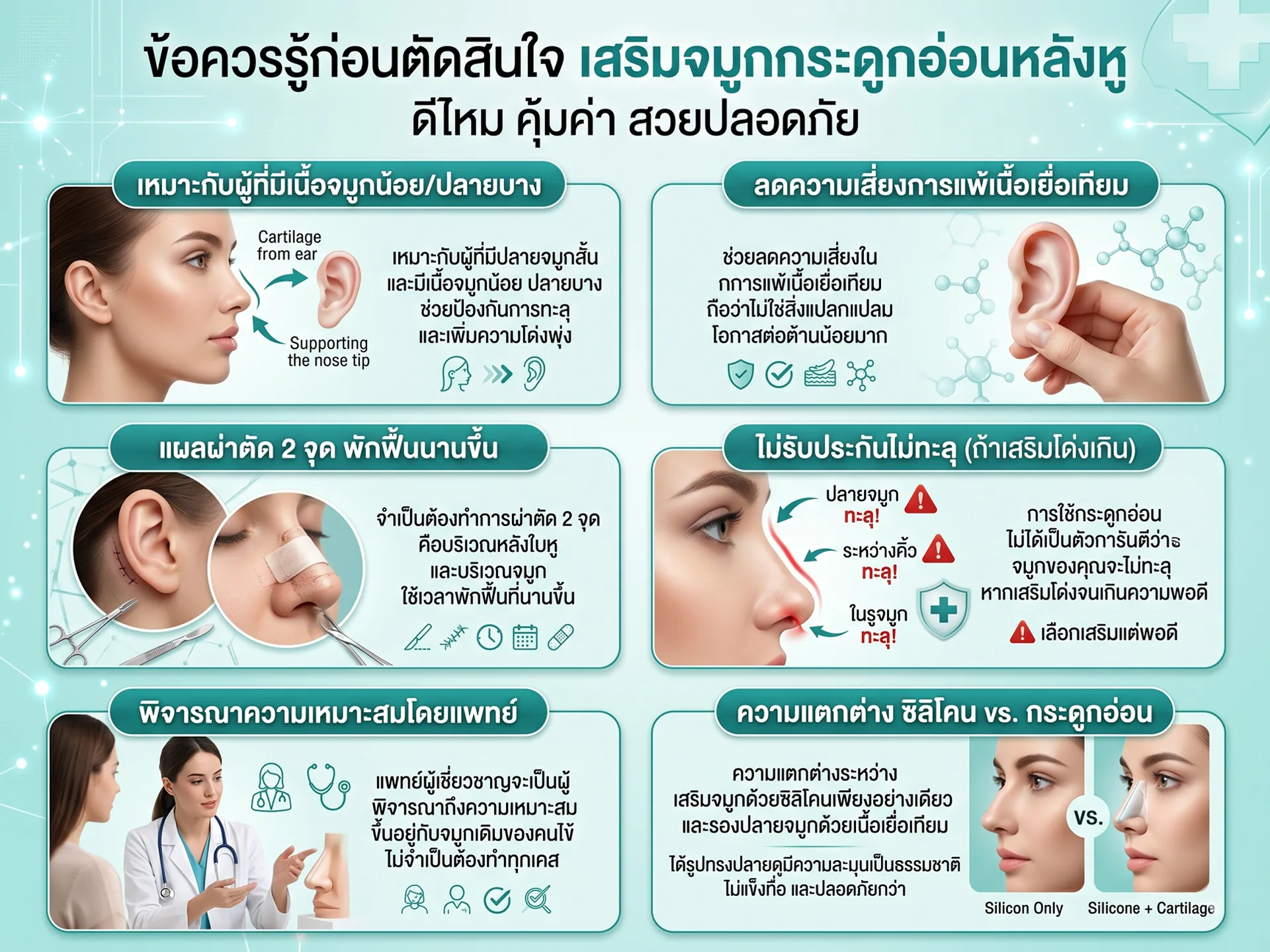 ข้อควรรู้ก่อนตัดสินใจ เสริมจมูกกระดูกอ่อนหลัง