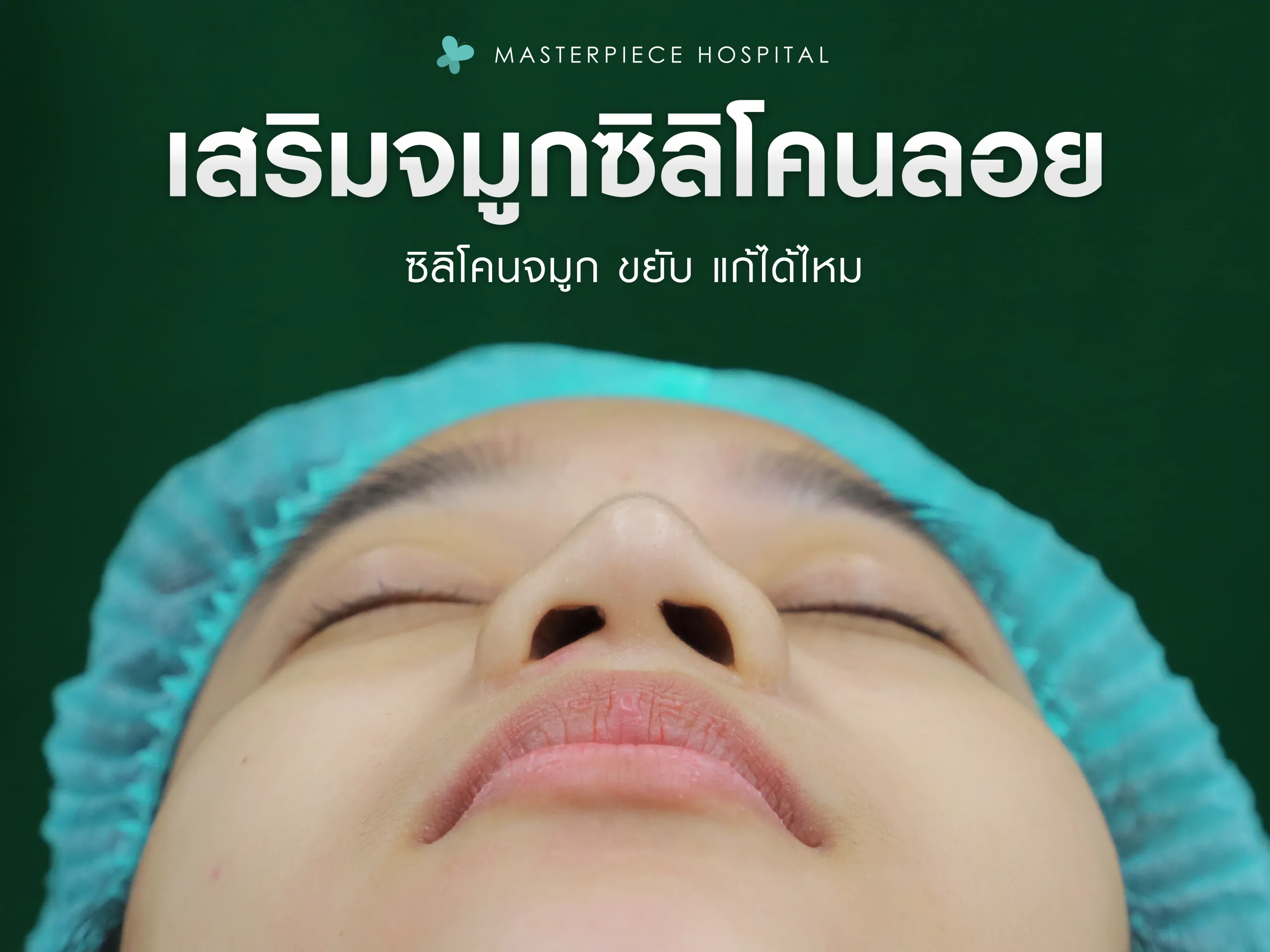 เสริมจมูกซิลิโคนลอยขยับได้ แก้ได้ไหม