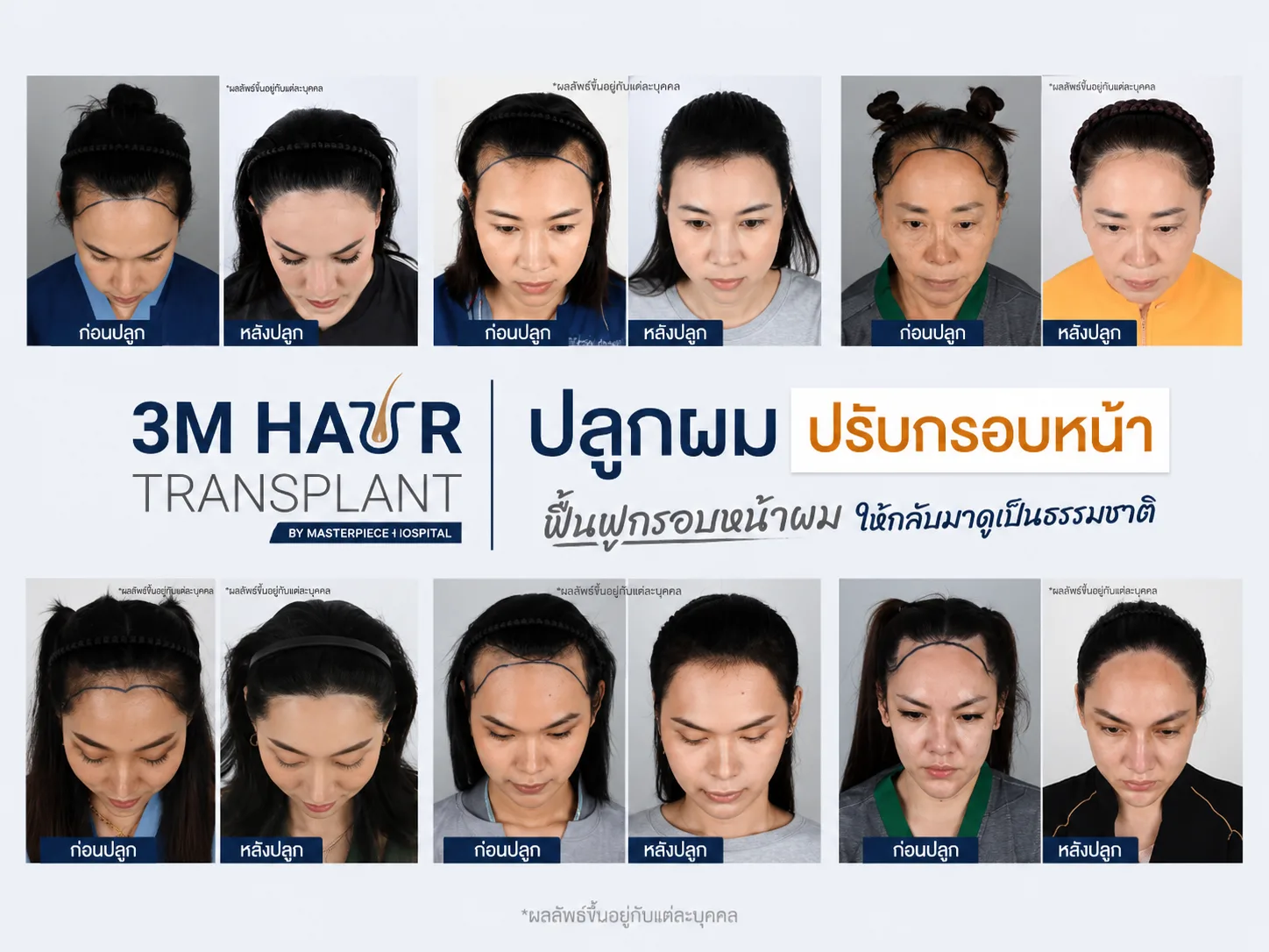 รูปทรงใบหน้าหรือกรอบหน้าแบบต่าง ๆ