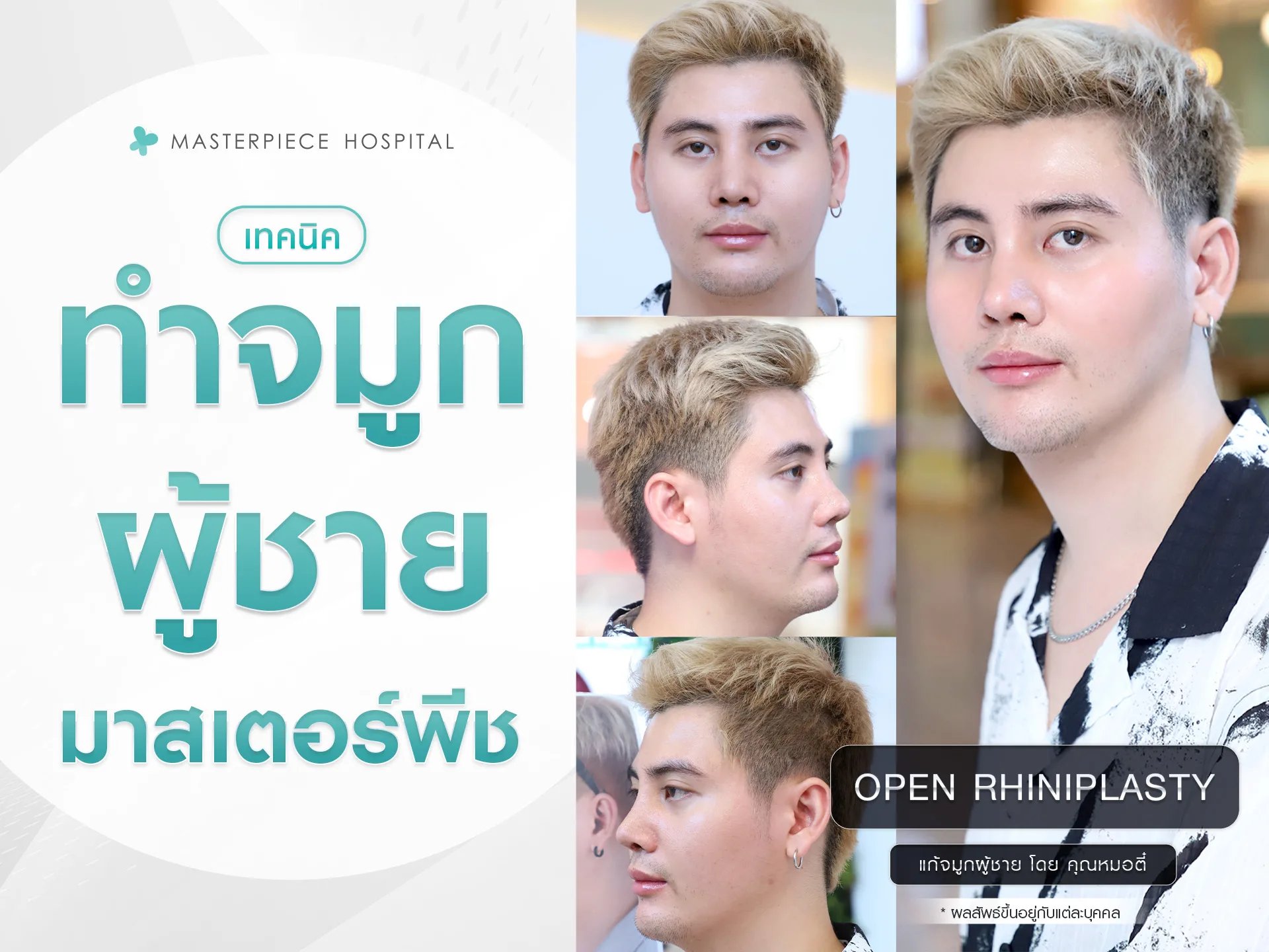 เทคนิคทำจมูกผู้ชาย-กับมาสเตอร์พีช