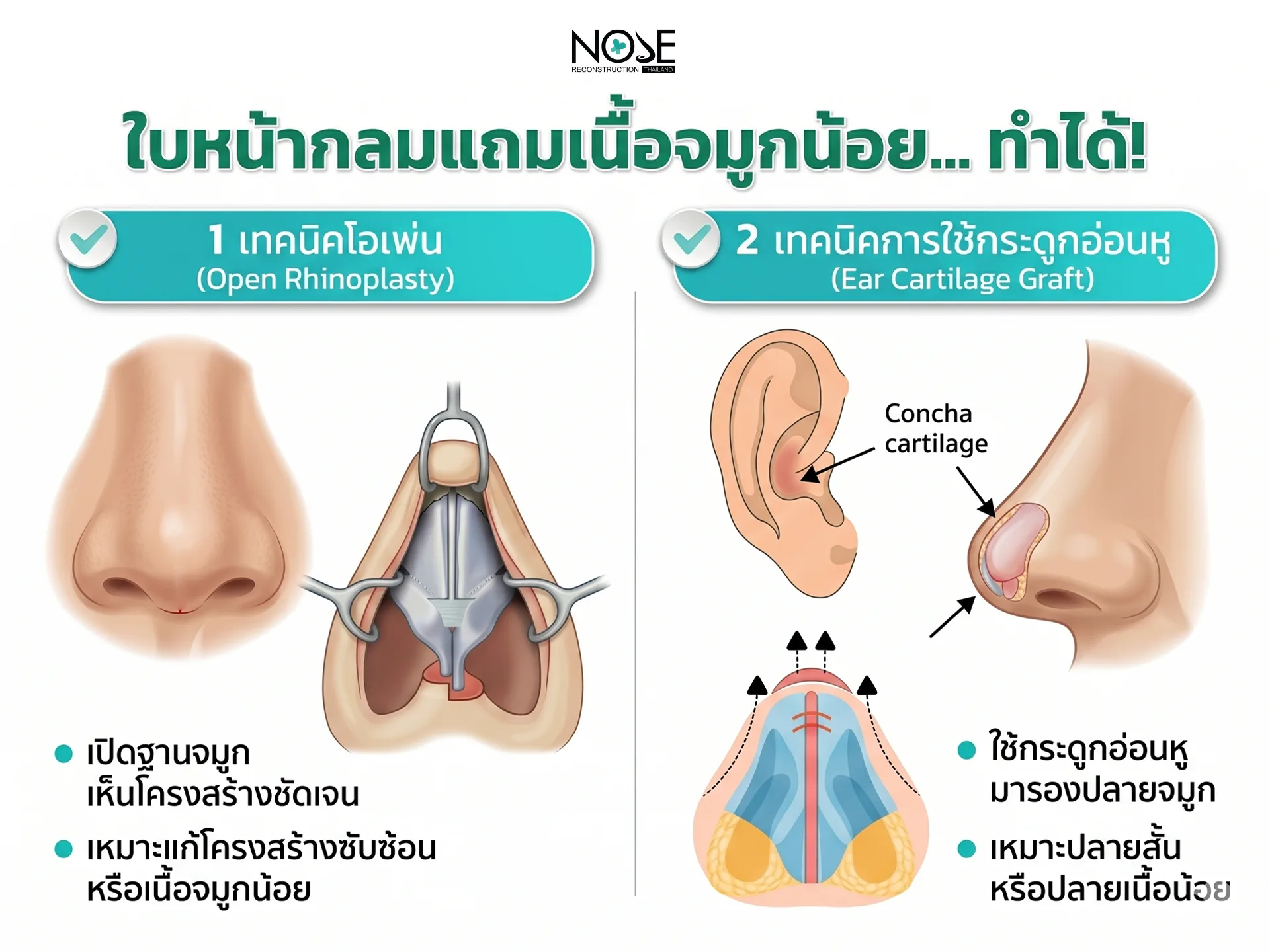 บหน้ากลมแถมเนื้อจมูกน้อย ทำได้ไหม