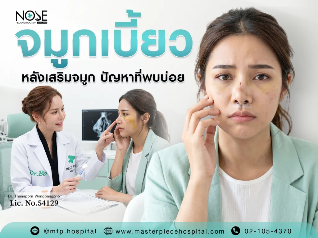 จมูกเบี้ยวหลังเสริม ปัญหาที่พบบ่อยหลังเสริมจมูก