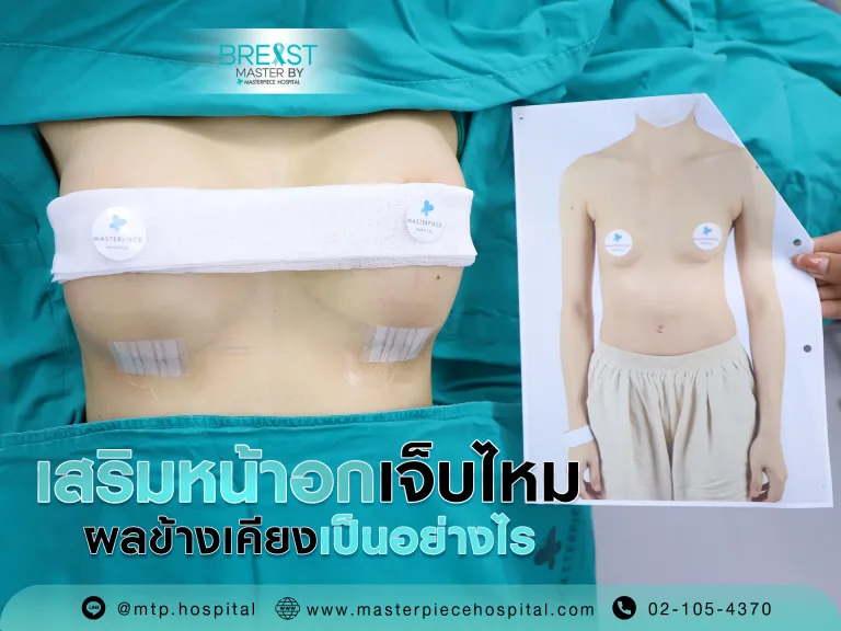 เสริมหน้าอกเจ็บไหม ผลข้างเคียงเป็นอย่างไร