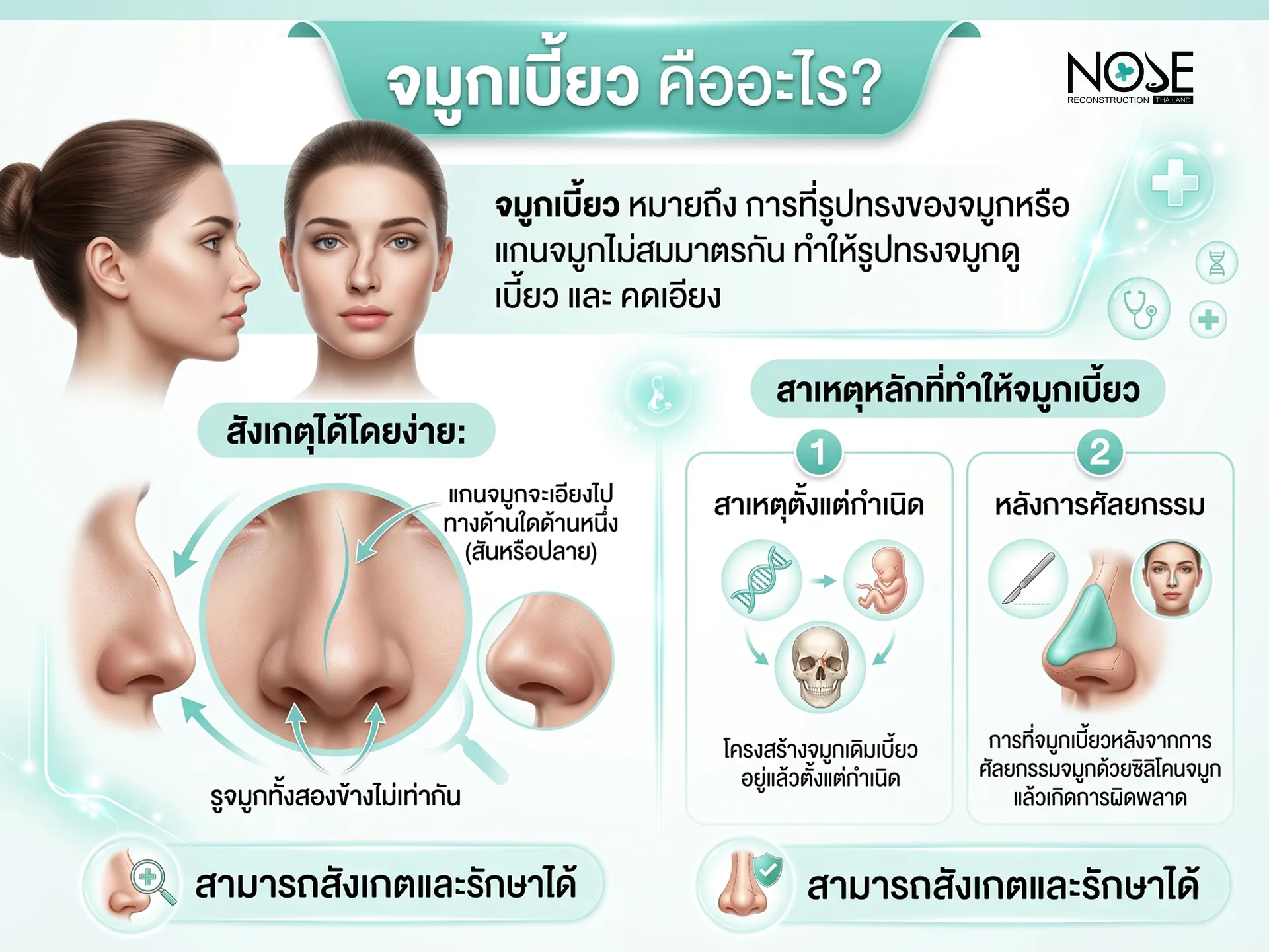 จมูกเบี้ยว คืออะไร