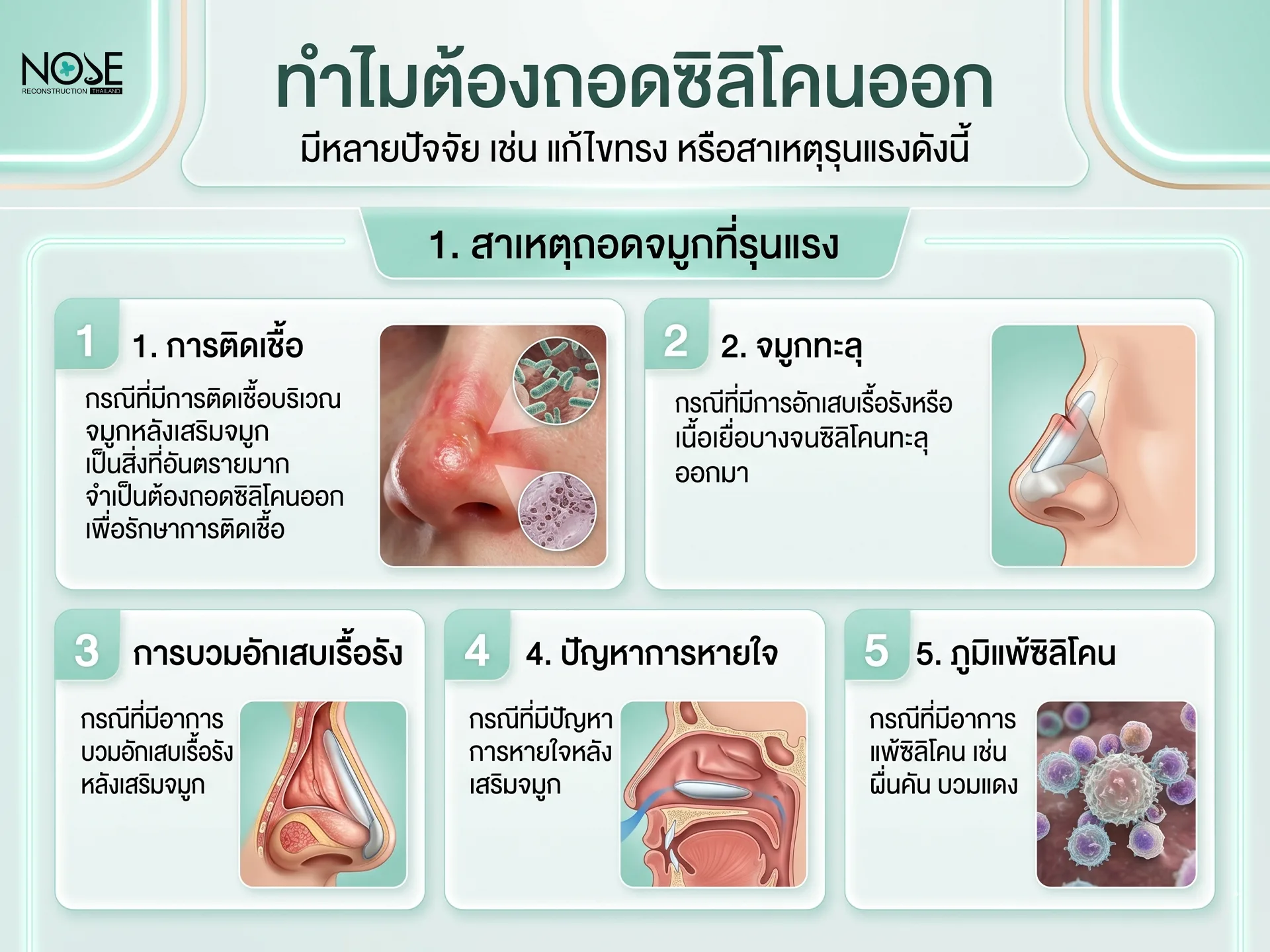 ทำไมต้องถอดซิลิโคนออก