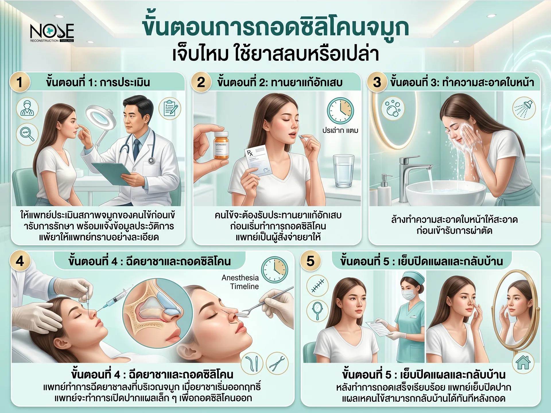 ขั้นตอนการถอดซิลิโคนจมูก