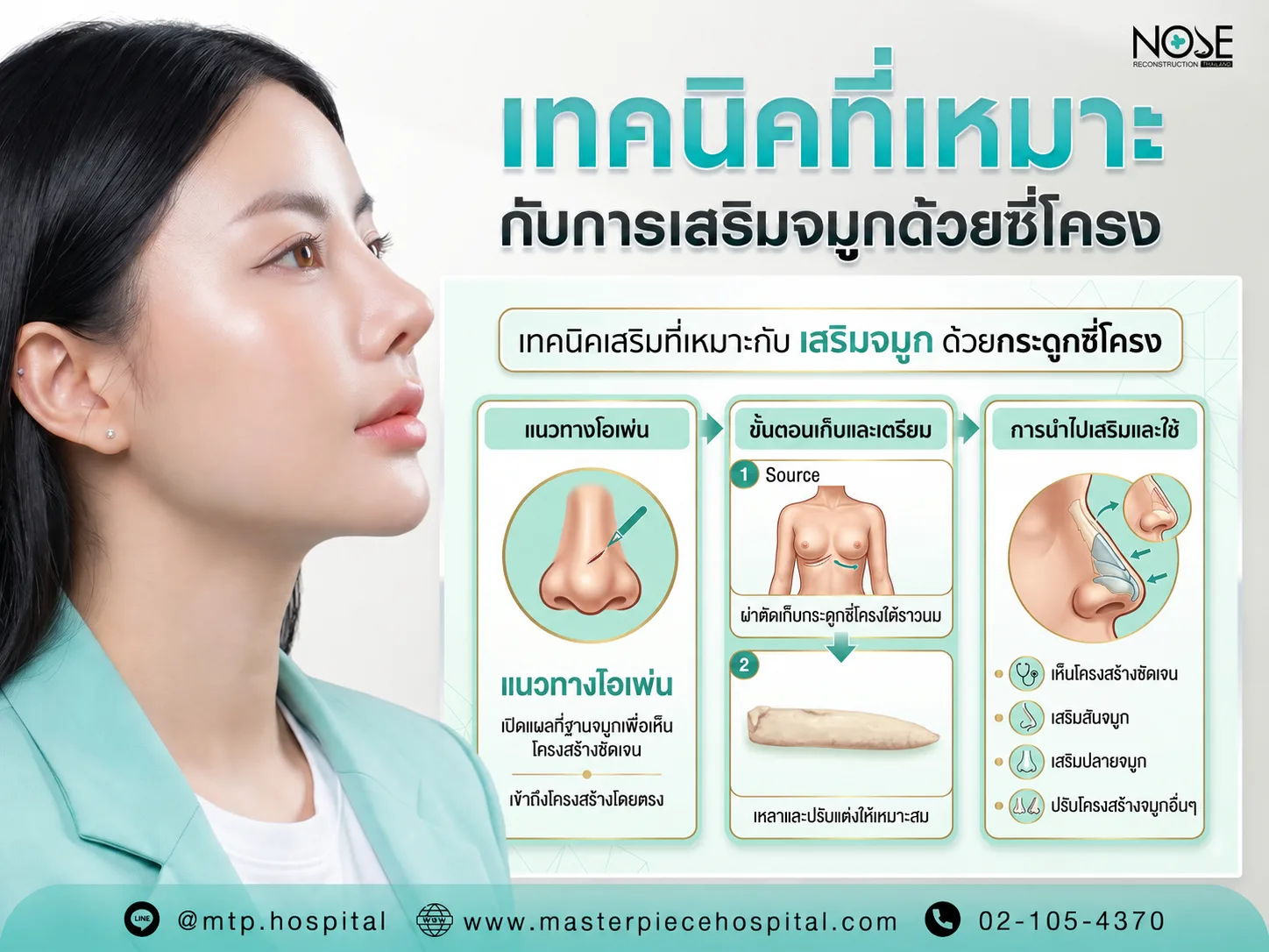 เทคนิคเสริมที่เหมาะกับเสริมจมูกด้วยกระดูกซี่โครง