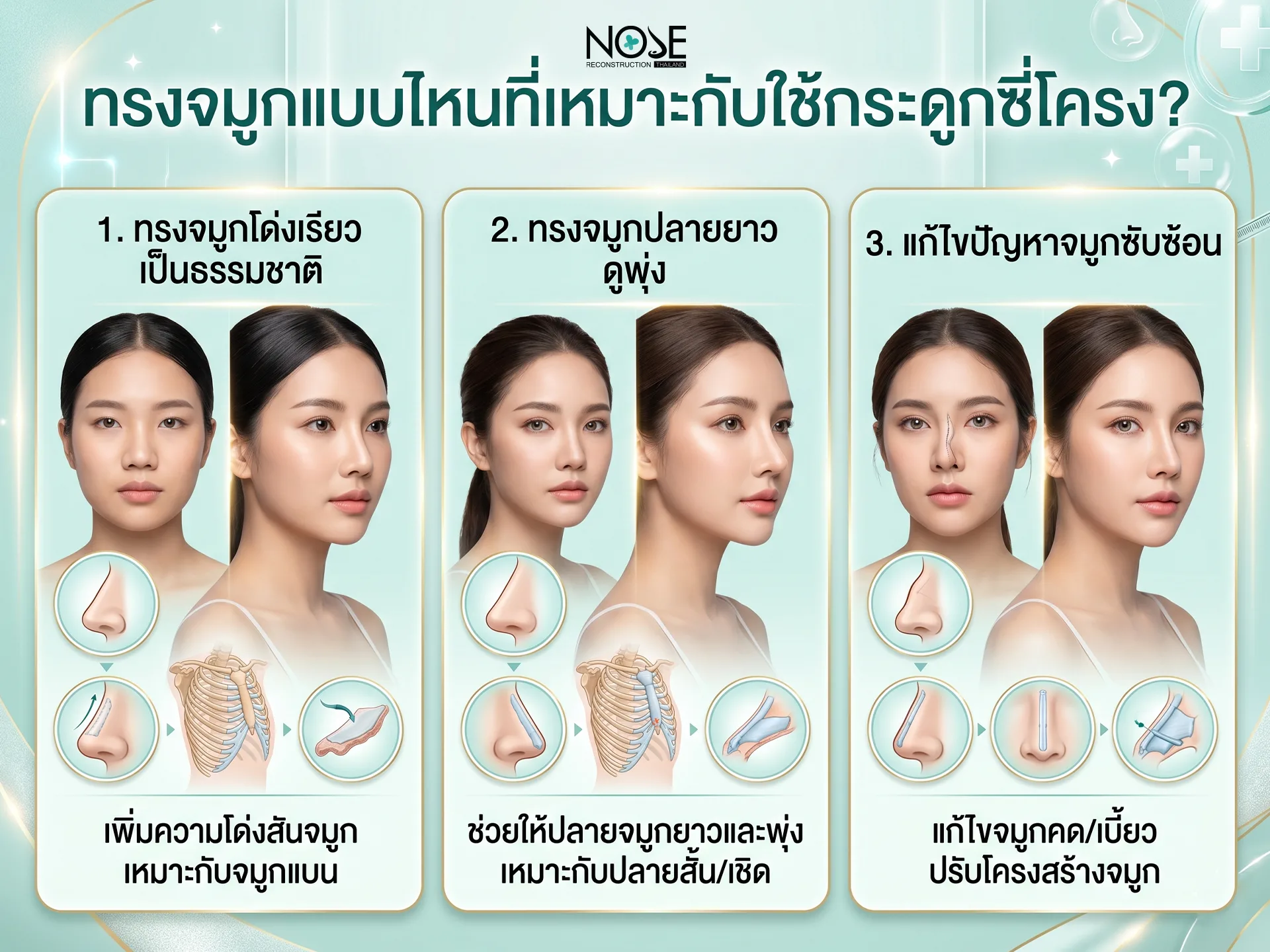 ทรงจมูกแบบไหนที่เหมาะกับใช้กระดูกซี่โครง ?