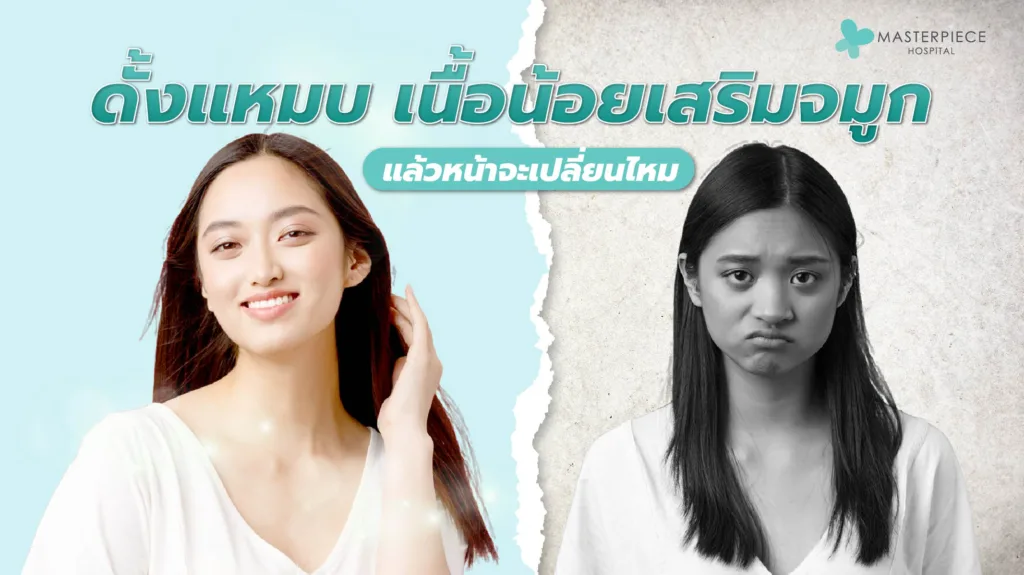 ดั้งแหมบ เนื้อน้อยเสริมจมูกแล้วหน้าจะเปลี่ยนไหม