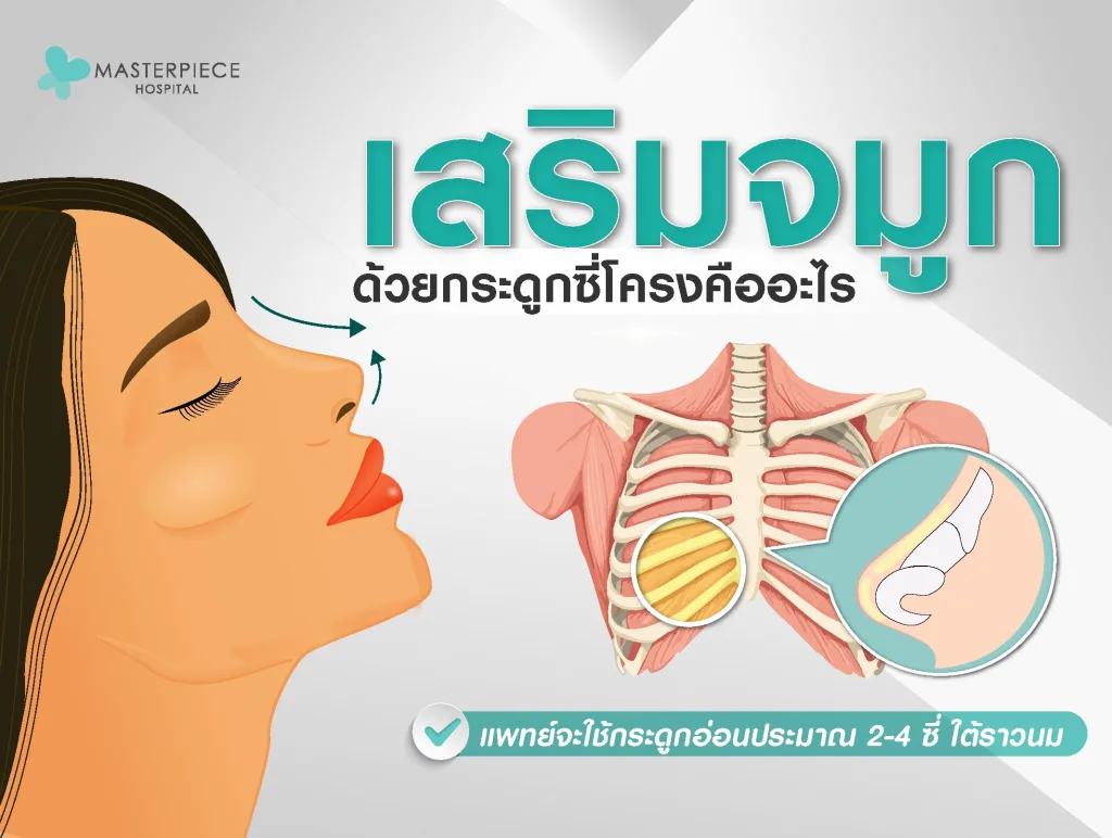 เสริมจมูก ด้วยกระดูกซี่โครง คืออะไร