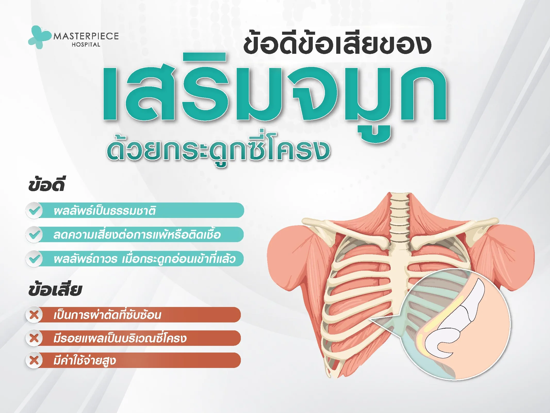 ข้อดีข้อเสียของ เสริมจมูก ด้วยกระดูกซี่โครง