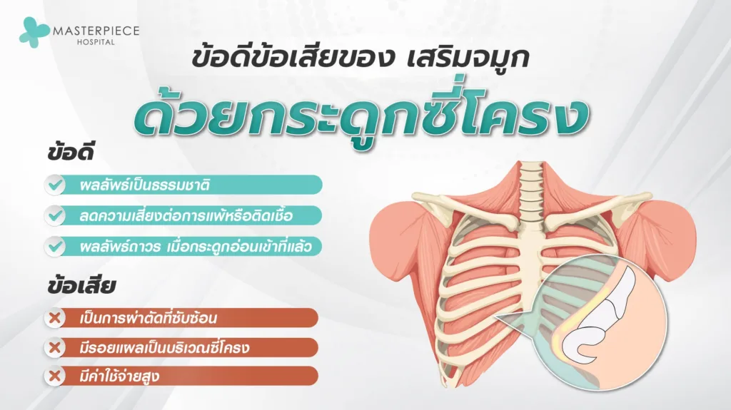 ข้อดีข้อเสียของ เสริมจมูก ด้วยกระดูกซี่โครง