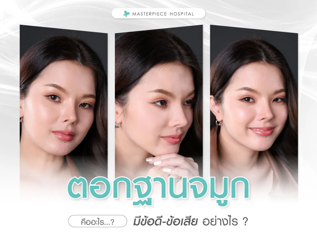 ตอกฐานจมูกคืออะไร มีข้อดีข้อเสียอย่างไร?