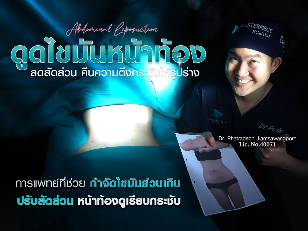 ดูดไขมันหน้าท้อง