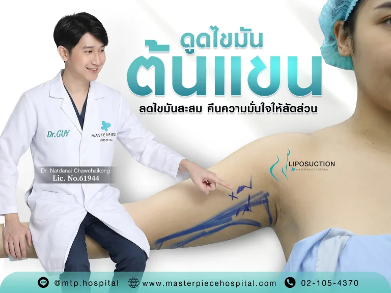 ดูดไขมันต้นแขน